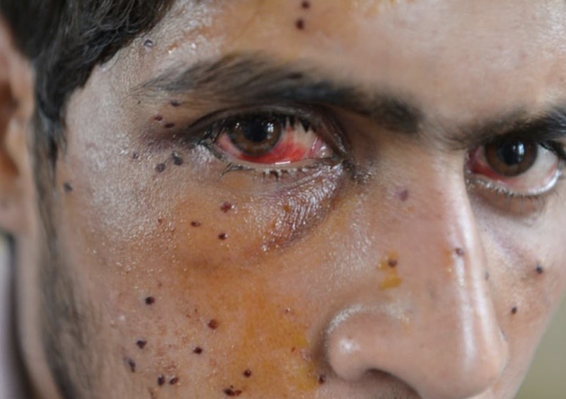 Fact-Sheet on Human Rights Violations in Indian Occupied Jammu and Kashmir (IoK), February 2019